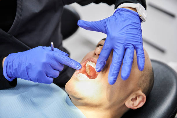 Best Emergency Wisdom Tooth Extraction in Atlantic Beach, FL